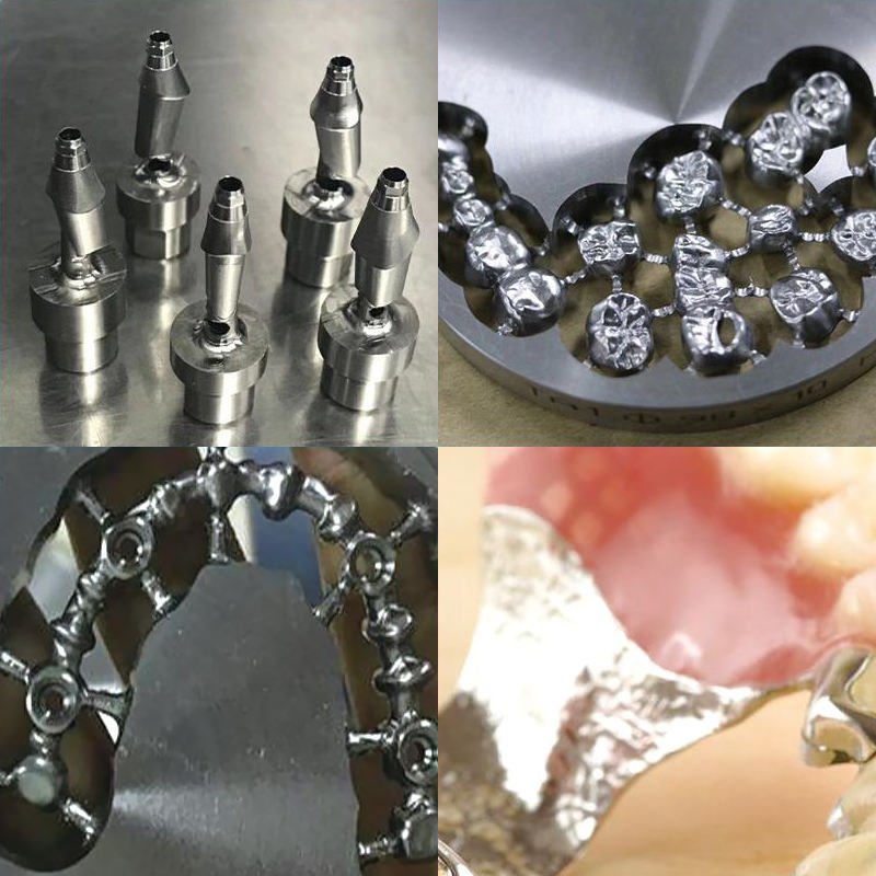 titanium dental prostheses fabricated in laboratory