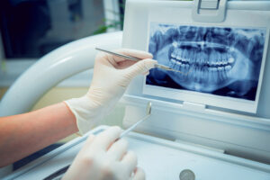 What is surgical orthodontics?
